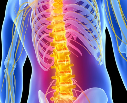 Spinal Cord Injury